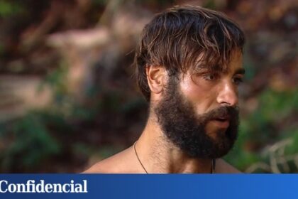 Arias no se rapa por contrato con ‘Supervivientes’