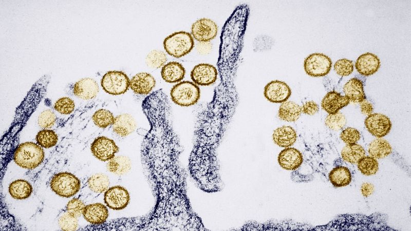 ¿Qué es el hantavirus y cómo se propaga?