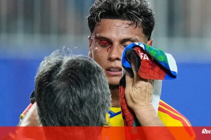 Asi quedo la ceja de Richard Rios tras el choque en Colombia-Ghana