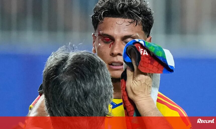 Asi quedo la ceja de Richard Rios tras el choque en Colombia Gana