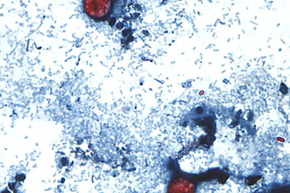Mas de mil casos de Cyclospora en Michigan y Ohio