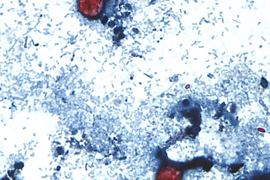 Mas de mil casos de Cyclospora en Michigan y Ohio